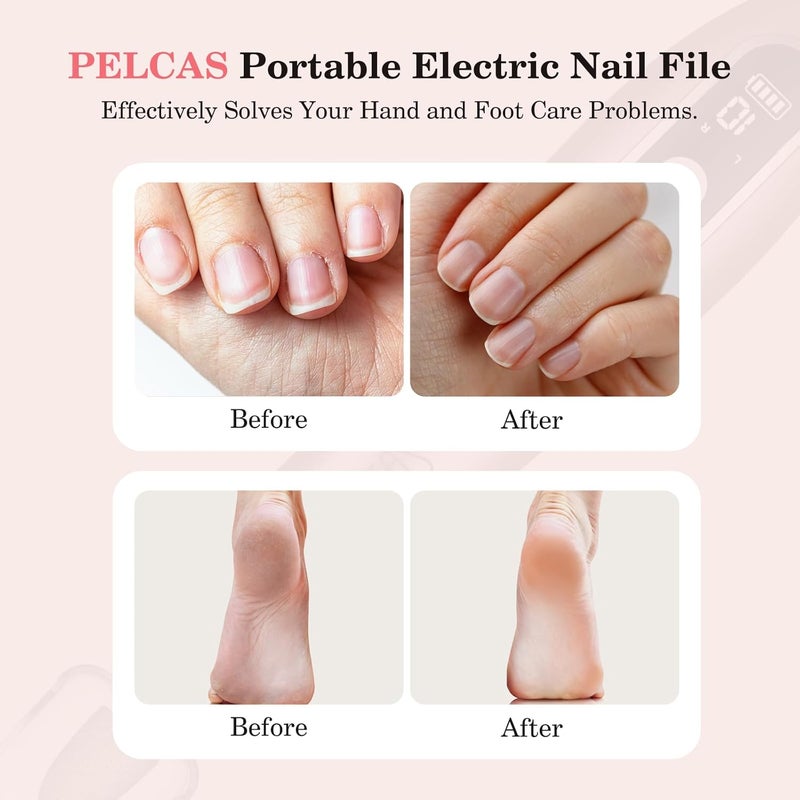 PELCAS Electric Nail File, 10 Speeds Cordless Nail Drill Kit with LED Light, Professional Nail Grinder with LCD Screen Portable e File for Human, Pet, Thick Toenails, Natural & Acrylic Nails Pink - Image 2